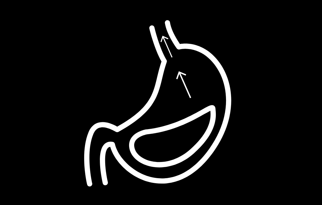 How Alkaline Water Eases Heartburn alk water